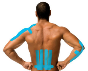 What is Kinesiology Tape