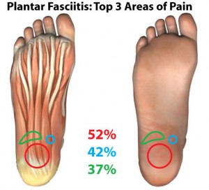 rock tape strapping for plantar fasciitis