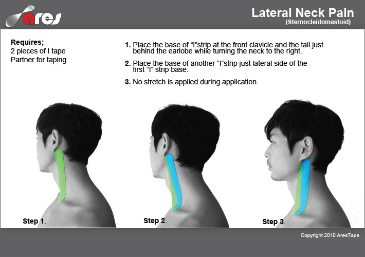 Lateral-neck-pain