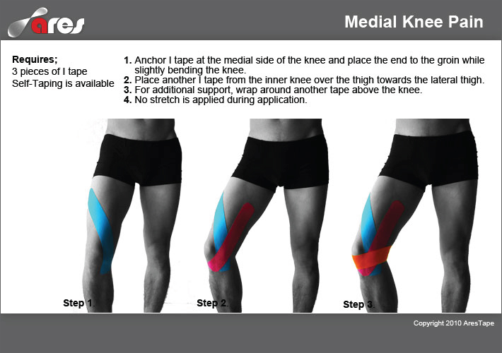 Medial-Knee-Pain