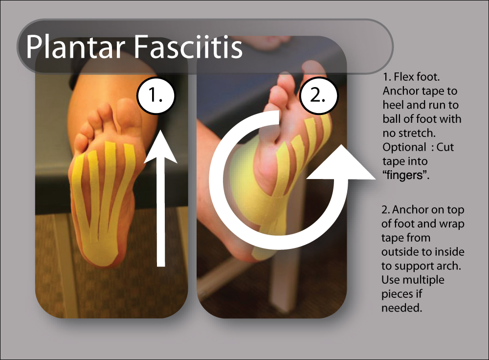 Plantar Fasciitis RockTape • TheraTape Education Center