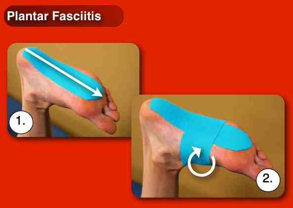 sports tape for plantar fasciitis sports tape for plantar fasciitis